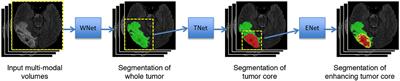 Automatic Brain Tumor Segmentation Based on Cascaded Convolutional Neural Networks With Uncertainty Estimation